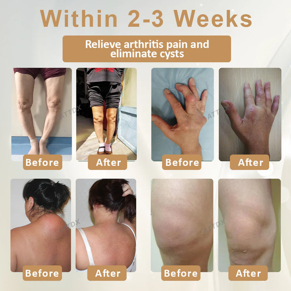 ATTDX® Emu Oil Turmeric UricRelief Therapy Gel 2 ATTDX® Emu Oil Turmeric UricRelief Therapy Gel