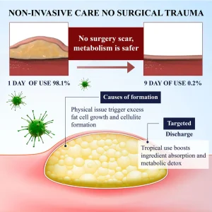 Cvreoz® LipoEase Herbal Matrix-4 Cream