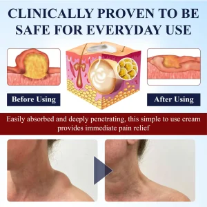 Cvreoz® LipoEase Herbal Matrix-4 Cream