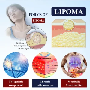 Cvreoz® LipoEase Herbal Matrix-4 Cream