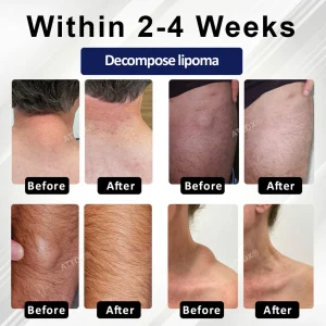 Cvreoz® LipoEase Herbal Matrix-4 Cream