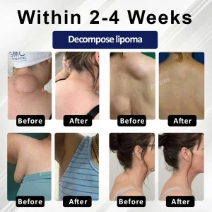 Cvreoz® LipoEase Herbal Matrix-4 Cream