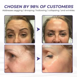 Brightmarsh® ElastaPro Emu Oil Skin Firming Cream