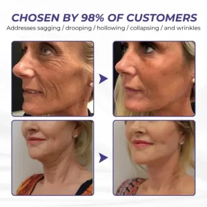 Brightmarsh® ElastaPro Emu Oil Skin Firming Cream