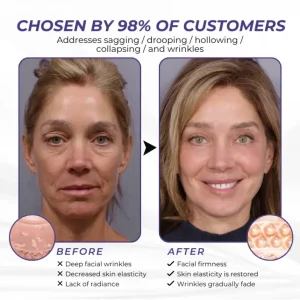 Brightmarsh® ElastaPro Emu Oil Skin Firming Cream