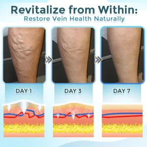 GFOUK® VenaRestore MicroNeedle Vein Repair Patch