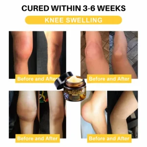 NovaRX® Pain Relief & Bone Healing Cream with Bee Venom