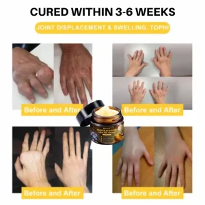 NovaRX® Pain Relief & Bone Healing Cream with Bee Venom