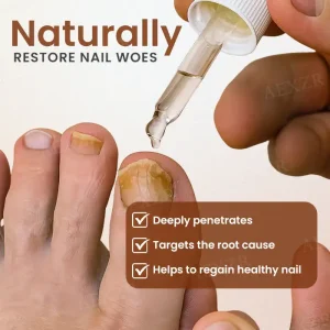 Piguiay® Nails Repairing Serum