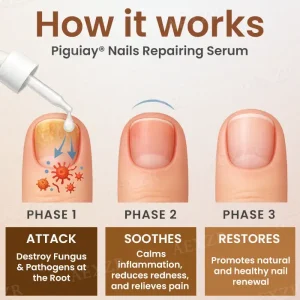 Piguiay® Nails Repairing Serum