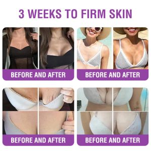 Furzero® Queen Nectar Peptide + Bakuchiol Skin Restoration Cream