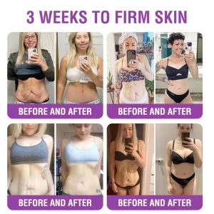 Furzero® Queen Nectar Peptide + Bakuchiol Skin Restoration Cream