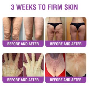 Furzero® Queen Nectar Peptide + Bakuchiol Skin Restoration Cream