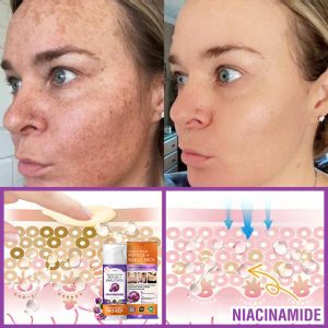 Furzero® Queen Nectar Peptide + Bakuchiol Skin Restoration Cream