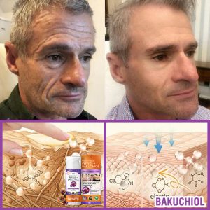 Furzero® Queen Nectar Peptide + Bakuchiol Skin Restoration Cream