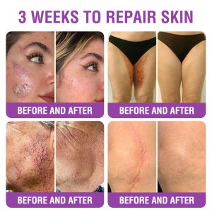 Furzero® Queen Nectar Peptide + Bakuchiol Skin Restoration Cream