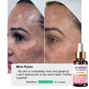 TAILEDEN® MelantraX Advanced Brightening Essence ACE