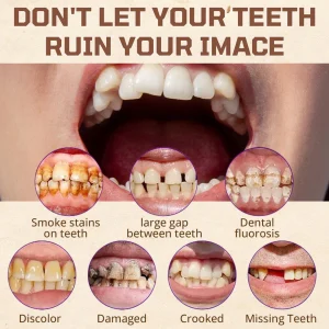 Cvreoz® Adsorptive denture