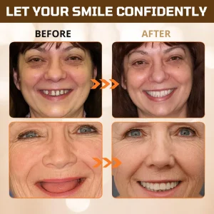 Cvreoz® Adsorptive denture