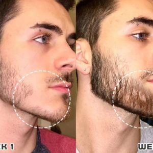 Put an end to hair loss with LOVILDS™ Rollerball Serum