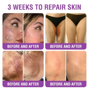 YUNPSO™ Queen Nectar Peptide + Bakuchiol Skin Restoration Cream