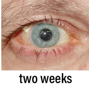 NESLEMY™ Nano Vision Repair Eye Serum