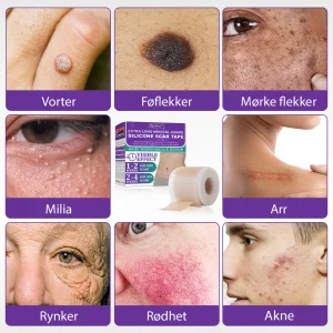 Flysmus® ReGen Hyaluronic Acid Nano-Heal Microneedle Tape