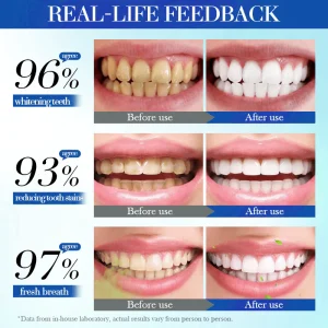 Alisanda Hydroxyapatite Toothpaste 7.5% for Enamel Repair & Teeth Whitening Refreshing Flavor Fluorid