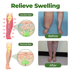 BBOJI® Professional Leg Circulation Cream