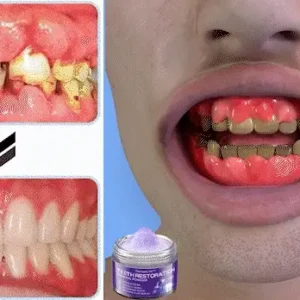 Onyikey™ Teeth Restoration Mineral Powder