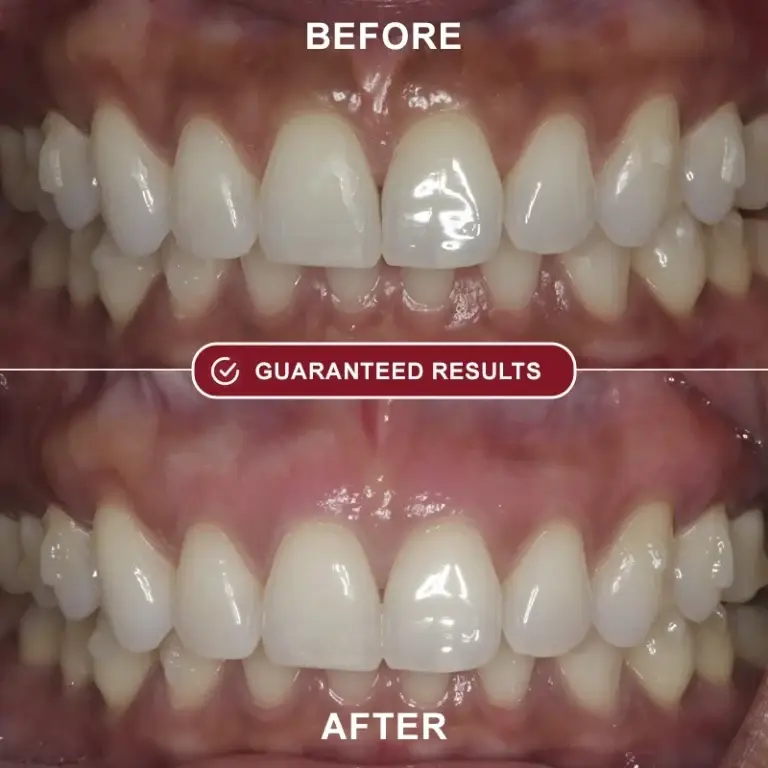 HealRay Red Light Therapy System 5 HealRay Red Light Therapy System