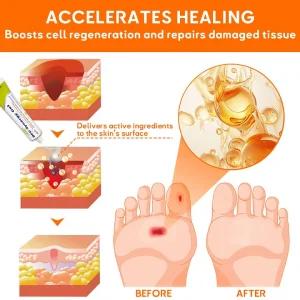 LAOZIK™ DFU Synergy Gel