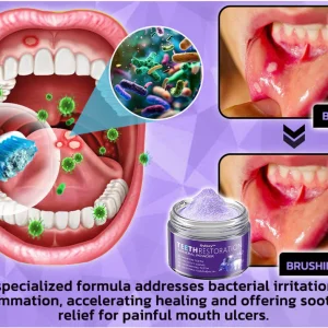 Onyikey™ Teeth Restoration Mineral Powder