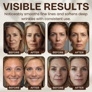 Snail Hydrating Anti-Wrinkle and Rejuvenating Cream