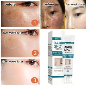 Bikenda™ Blemish Removing Beauty Cream 19 Bikenda™ Blemish Removing Beauty Cream