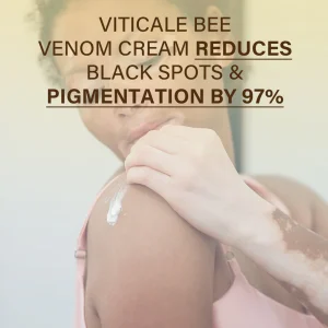 Oveallgo® VitiClear Bee Venom Cream Ultra