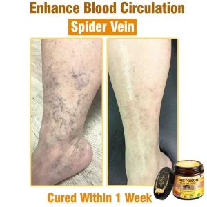 LOVILDS™ Bee Poison All-in-One Cream