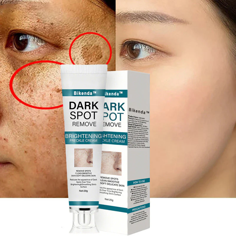 Bikenda™ Blemish Removing Beauty Cream 6 Bikenda™ Blemish Removing Beauty Cream