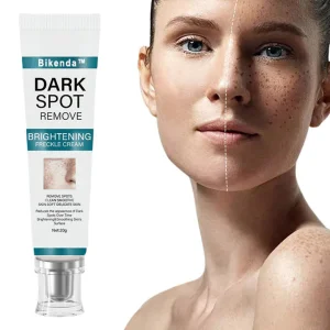 Bikenda™ Blemish Removing Beauty Cream 22 Bikenda™ Blemish Removing Beauty Cream