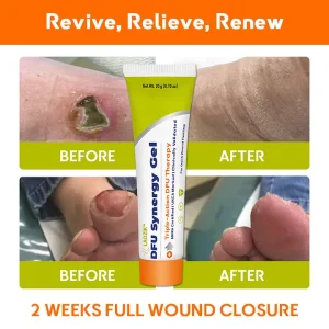 LAOZIK™ DFU Synergy Gel