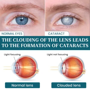 Lyyeto® OptiFusion Nano Eye Drops Serum 12 Lyyeto® OptiFusion Nano Eye Drops Serum