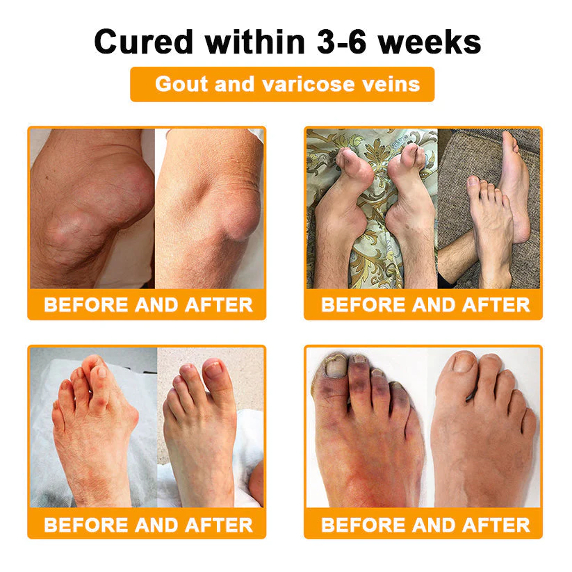 AQA™ Botulinum & Bee Essence Pain Relief Bone Healing Cream 8 AQA™ Botulinum & Bee Essence Pain Relief Bone Healing Cream