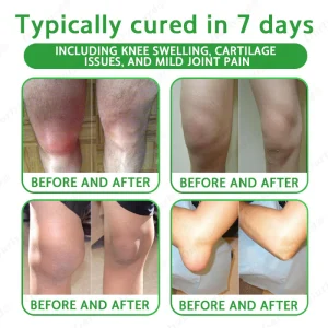 Ourlyard® Advanced Magnesium & Emu Oil Massage Pain Relief Cream