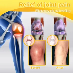 ADNOON™ Botulinum Toxin & Bee Venom Pain-Relief Bone Healing Cream