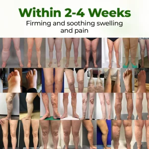 BBOJI® Professional Leg Circulation Cream