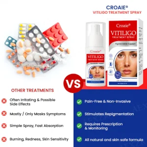 Croaie® Vitiligo Treatment Spray - No allergies