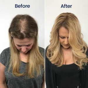 Biancat® Maximum Strength 5% Minoxidil Fast-Action Hair Growth Serum 14 Biancat® Maximum Strength 5% Minoxidil Fast-Action Hair Growth Serum