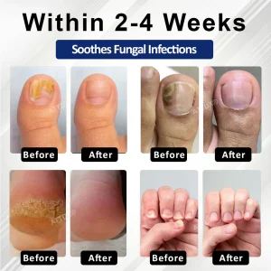 ATTDX® FungaGuard Botanica Roll On Stick