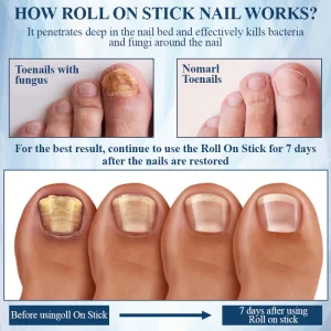 ATTDX® FungaGuard Botanica Roll On Stick