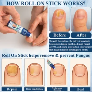 ATTDX® FungaGuard Botanica Roll On Stick